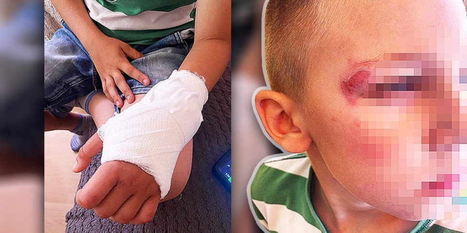 Pustili su ga da se sam, prestravljen i uplakan vrati kući! Majka mališana iz Šapca iznela šokantne detalje (FOTO)